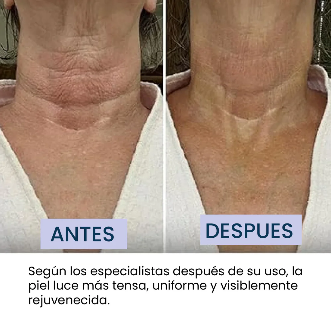 Crema Tonificadora Cuello GoPure ®
